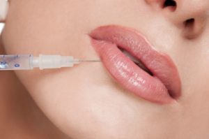 Juvederm- Injectable, Lips