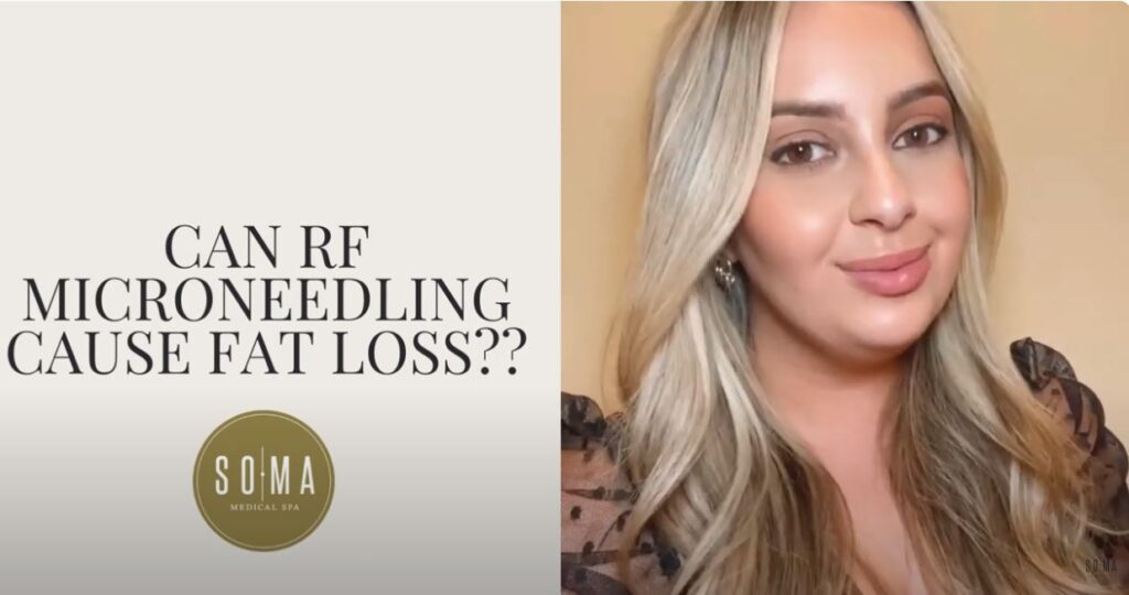 Does Radio Frequency Microneedling cause Fat Loss?? Soma Medical Spa